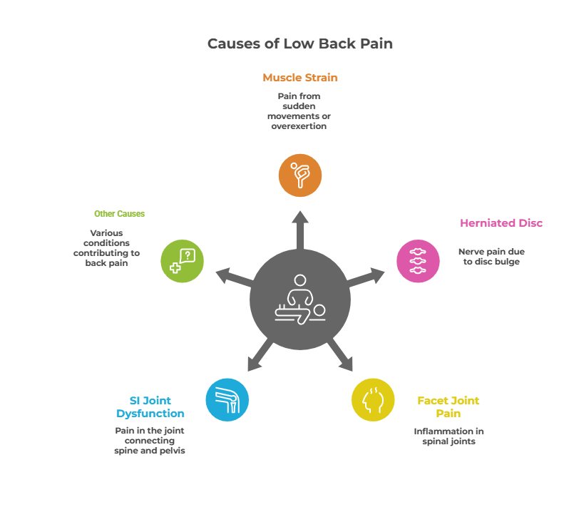 Common causes of low back pain