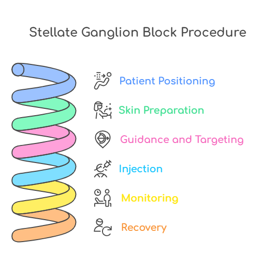 SGB Injection Procedure Explained