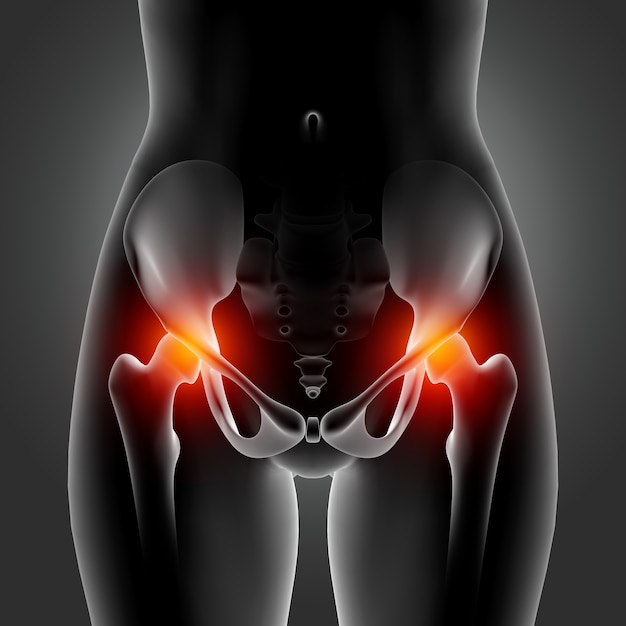 Expert Neurologist Tips for Pelvic Pain Relief in Santa Ana