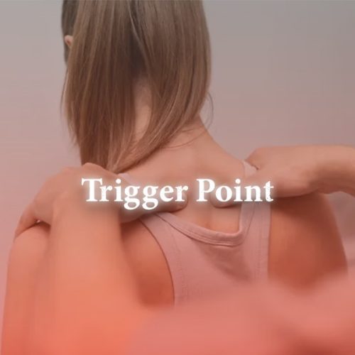 Trigger point