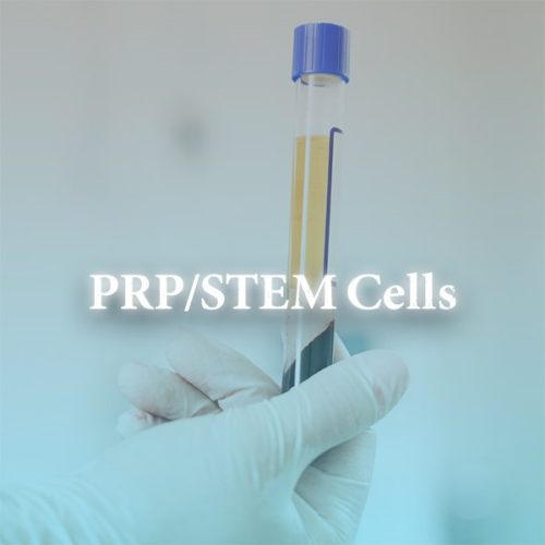 STEM cell PRP