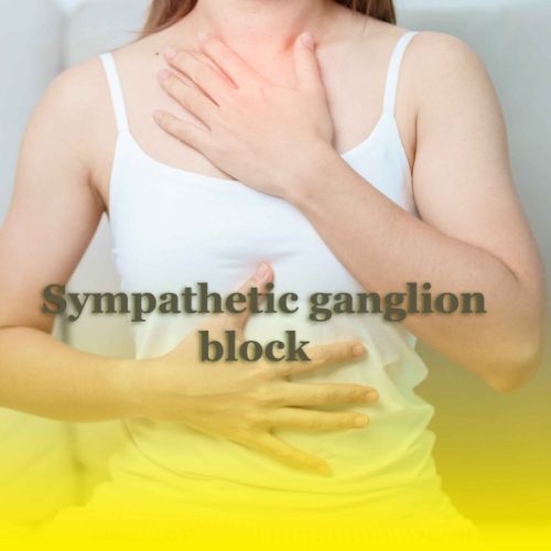 Sympathetic Ganglion Block
